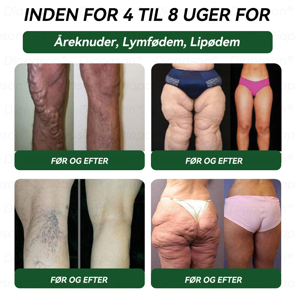 Officiel Butik | Diapason® GLP-1 9 I 1 Sundhedsløsning Oral Væske 🌿 Formel til beskyttelse mod kronisk sygdom