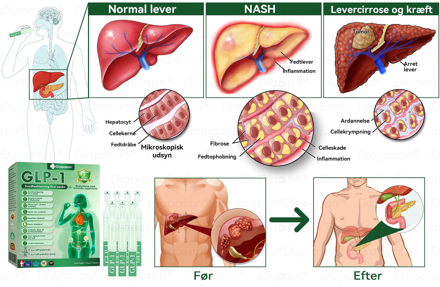 Officiel Butik | Diapason® GLP-1 9 I 1 Sundhedsløsning Oral Væske 🌿 Formel til beskyttelse mod kronisk sygdom ☀️