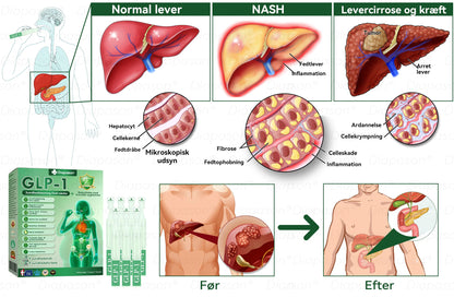 Officiel Butik | Diapason® GLP-1 9 I 1 Sundhedsløsning Oral Væske 🌿 Formel til beskyttelse mod kronisk sygdom ☀️